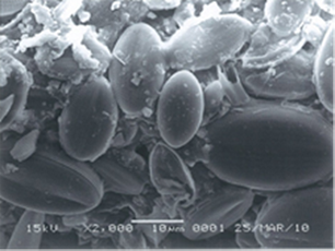 珪藻の電子顕微鏡写真 